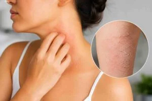 747aa5b0 9aa4 47cd bdf0 73c78649a4ea 300x200